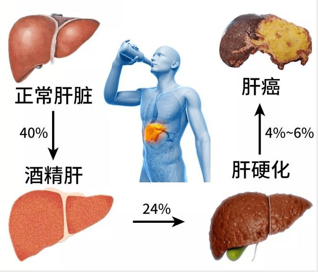 喝酒后喝绿茶能解酒吗_喝完酒喝绿茶能解酒吗_绿茶喝酒能喝解酒后的药吗