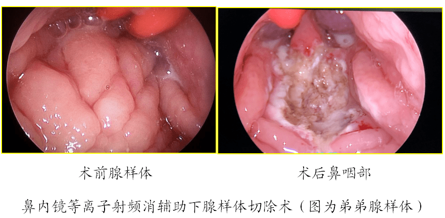 姜黄是什么药_姜黄是哪类药_中药姜黄是什么东西