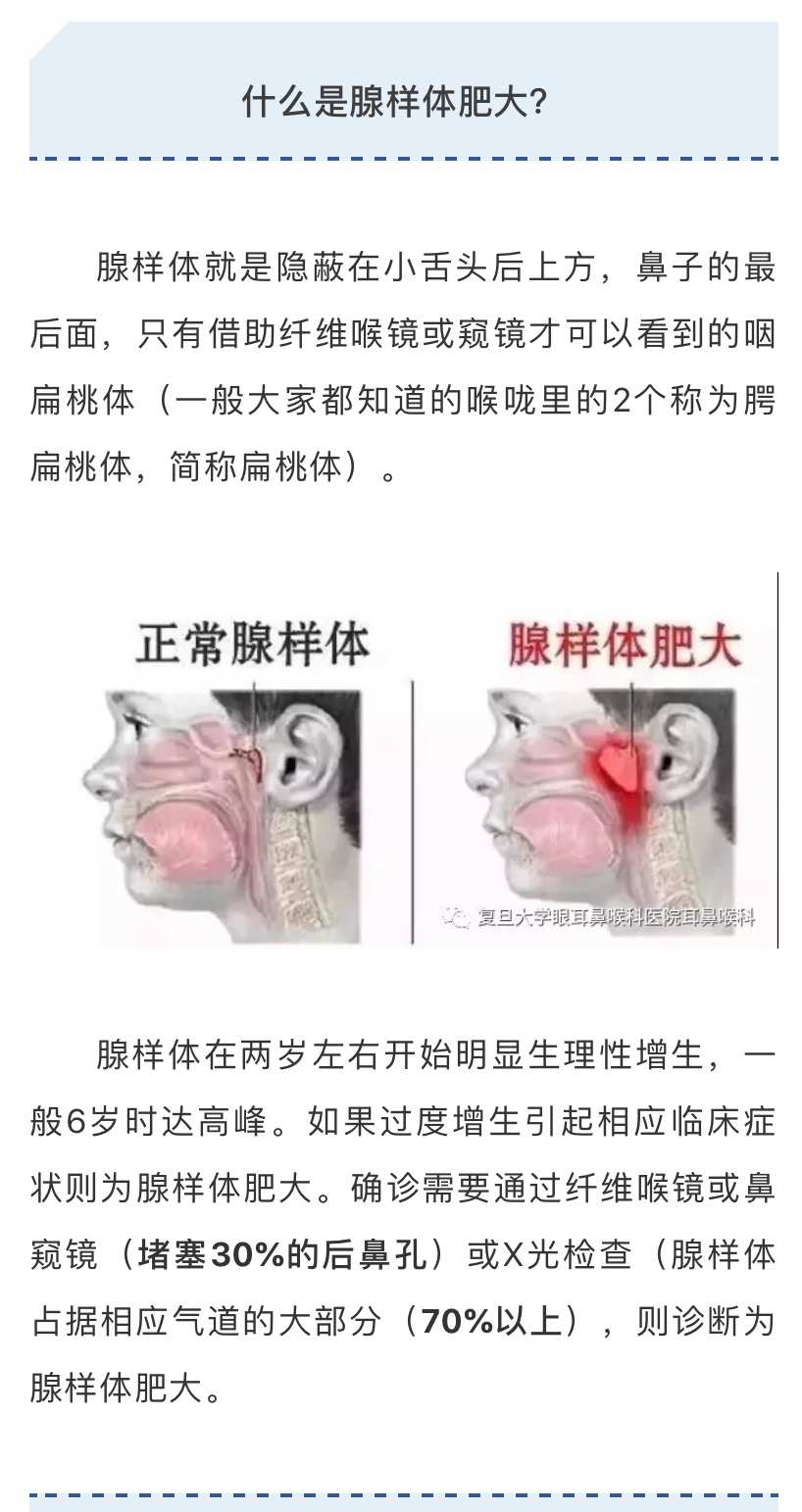 姜黄是什么药_中药姜黄是什么东西_姜黄是哪类药