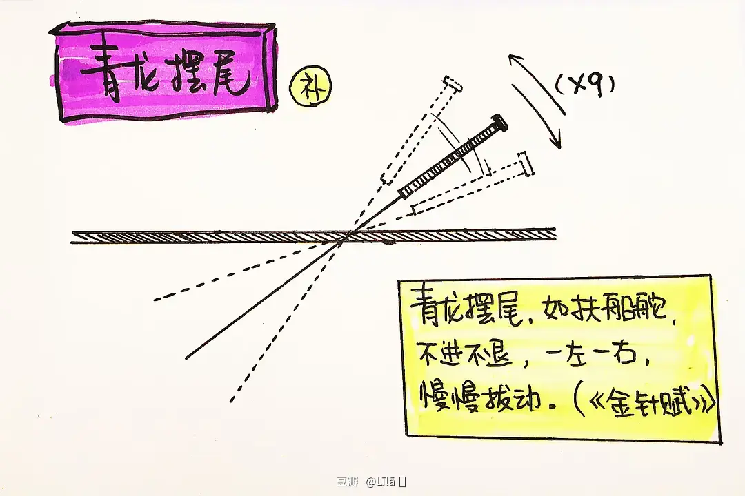 针灸行气是什么意思_针刺行气法_针灸行气法