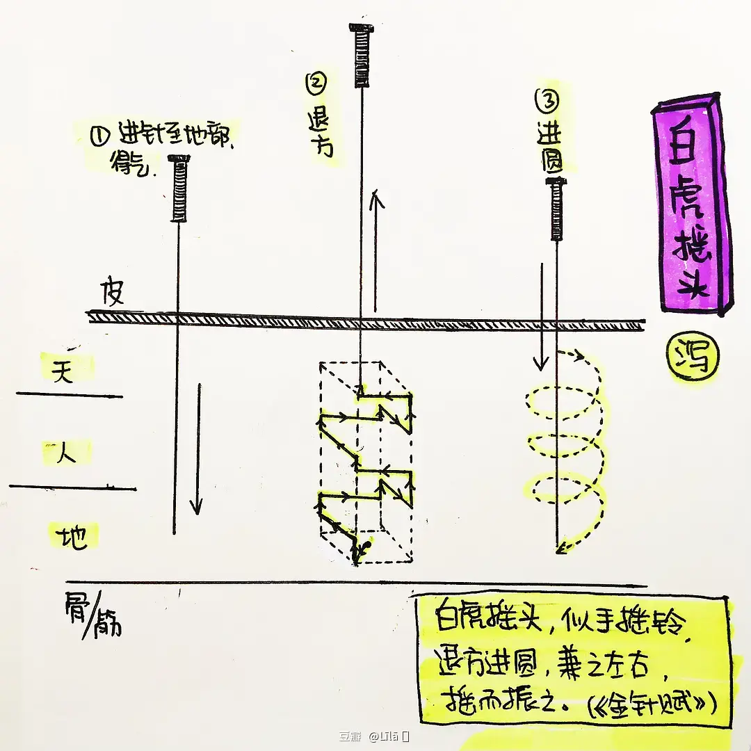 针灸行气法_针刺行气法_针灸行气是什么意思