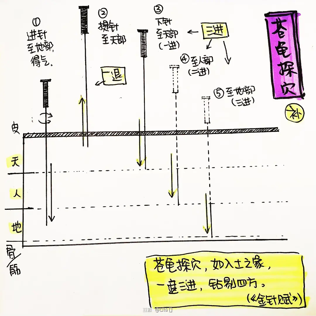 针灸行气法_针灸行气是什么意思_针刺行气法